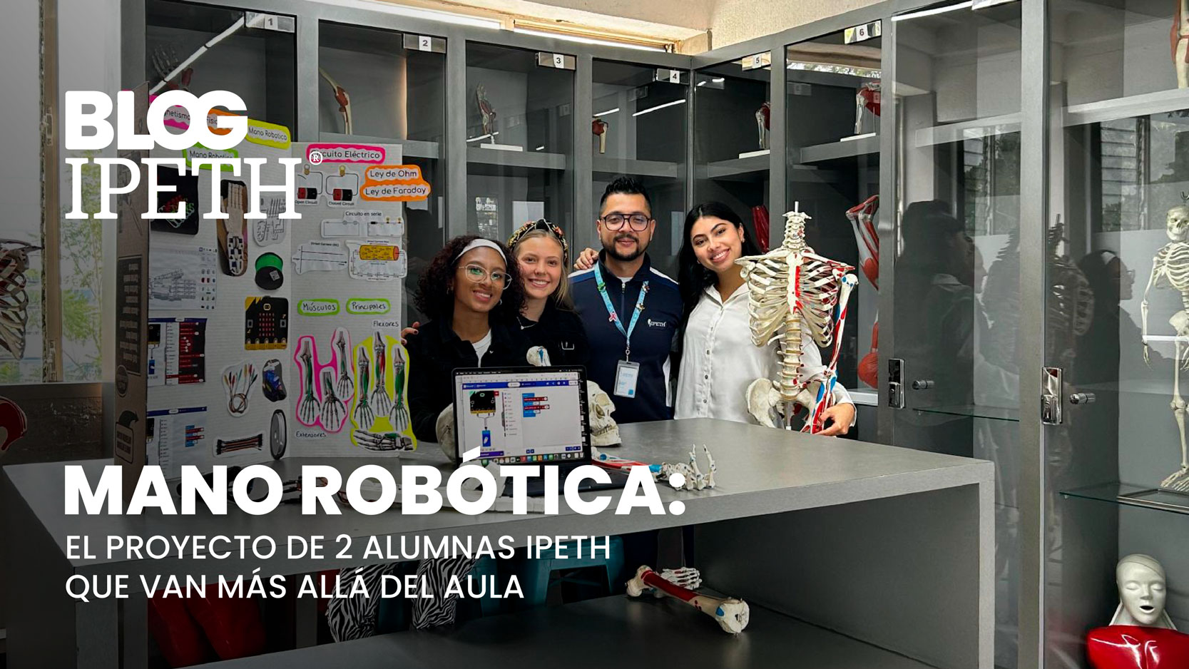 mano robotica protesis alumnas ipeth guatemala portada