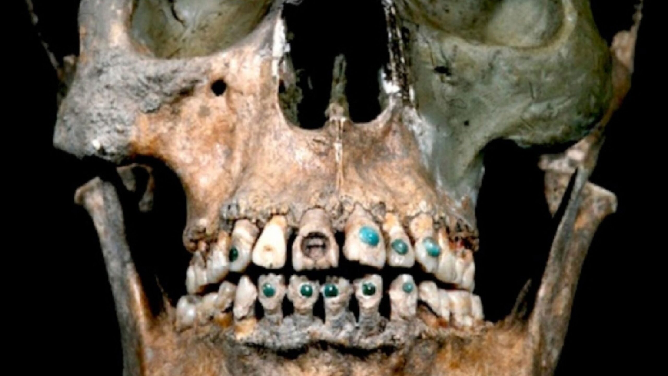 dia del dentista datos curiosos odotnologia piedras preciosas en dientes