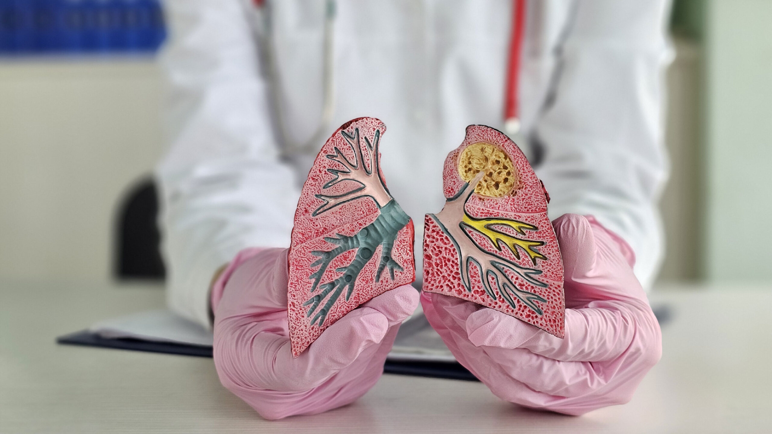 pulmon enfermo corte en que es la tuberculosis sintomas y como se ve